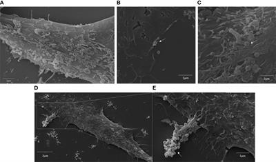 Mimiviruses Interfere With IκBα Degradation